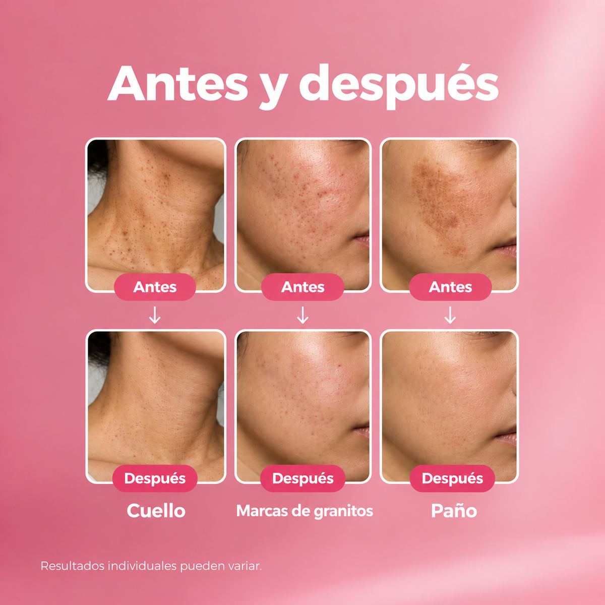 Sérum Antimanchas con Niacinamida y Ácido Tranexámico™